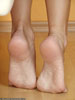 small preview pic number 19 from set 1226 showing Allyoucanfeet model Mel
